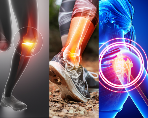 Knee, Shoulder & Ankle Sports Injuries